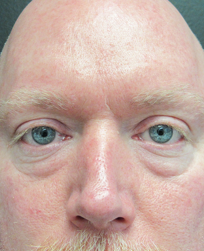 Surgery case study image