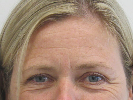 BOTOX® Cosmetic case #5490