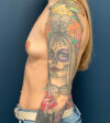 Breast Augmentation case #8400