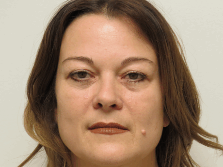 BOTOX® Cosmetic case #15899