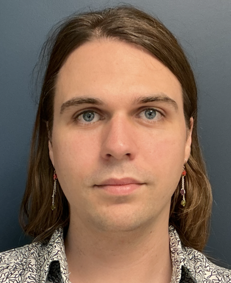 Facial Feminization Surgery case #20152