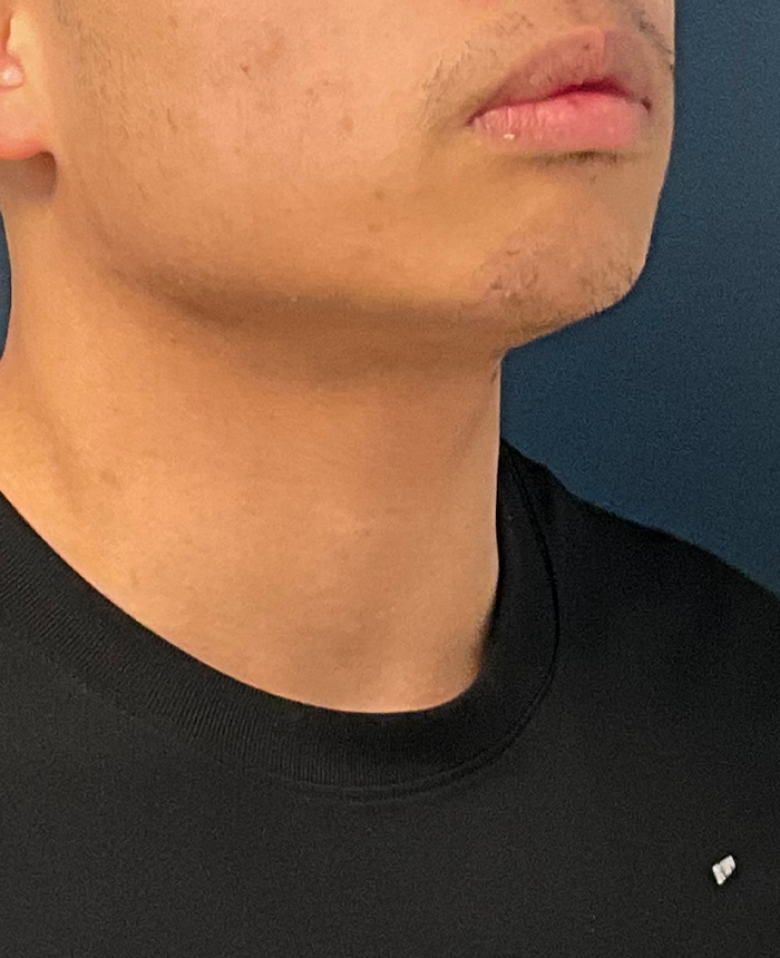 Gender Affirming Surgery case #20985